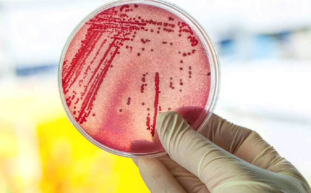 Test well water for Total Coliforms and E. coli bacteria annually
